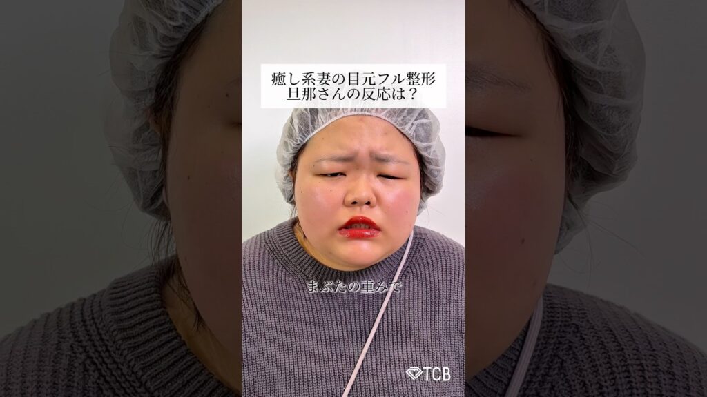 【二重整形】癒し系妻の目元フル整形！旦那さんの反応は？#shorts